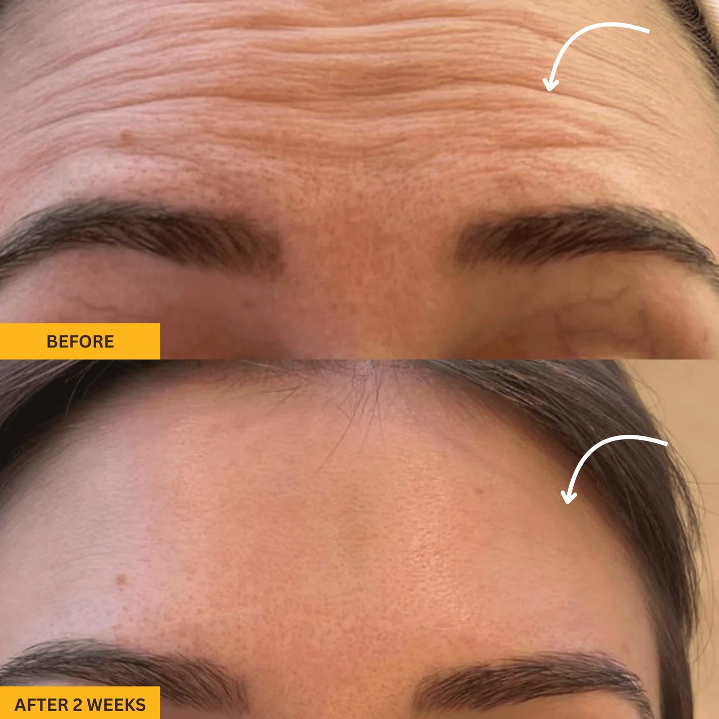 Lymphatic Contour Face Brush