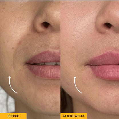 Lymphatic Contour Face Brush