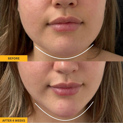 Lymphatic Contour Face Brush